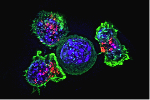 19 Cytotoxic Killer T cells surround a cancer cell 300